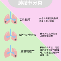 肺部结节