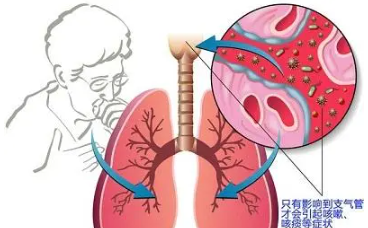 肺部有结节是怎么回事？要紧吗？