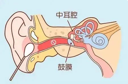 耳聋耳鸣