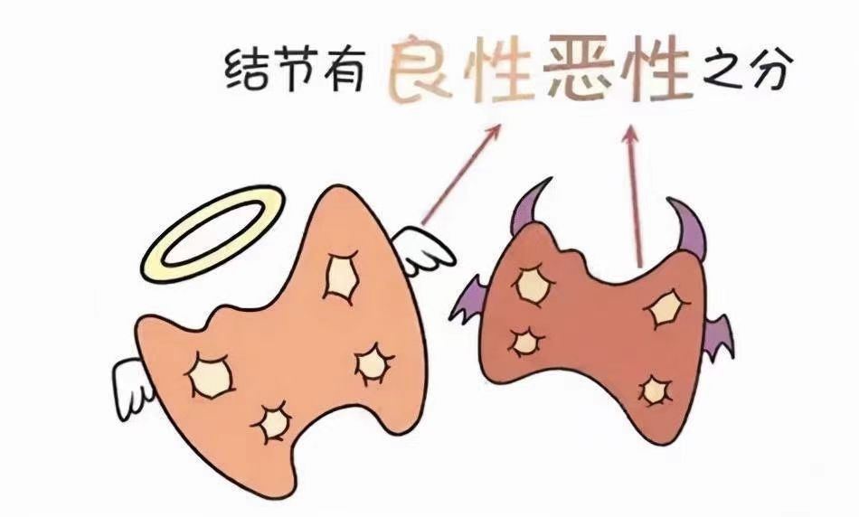 磨玻璃结节