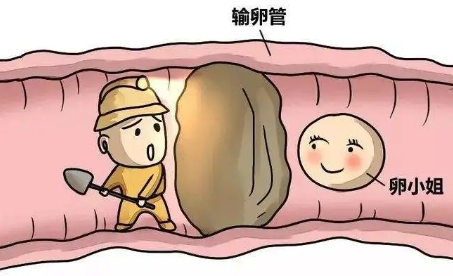 输卵管不通